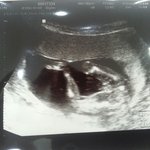 16주 <b>성별</b> 좀 봐주세요~