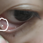 [댓글부탁] 혐오주의;;<b>눈밑</b>에 구멍이남ㅜㅜㅠ사진유