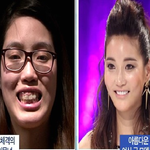 [남자의심리] 성형한 여자를 보는 남자의 시선