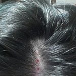 [톡톡] 머리에 구멍이 4개났어요