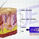 여름에도 브이라인이 될 수 있는 포인트미의 <b>에너</b>젯리프팅을 소개해용!