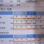 오늘 부산 <b>쥬비스</b> 상담받고 왔음