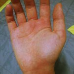 손이 이상해요....