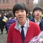 [EXO] 백현콧구멍축소<b>성형설</b>