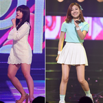 [몸매종결자] 다이어트의 정석 지방제로 정은지 다리!