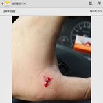 택배아저씨가 개한테 물렸어요.