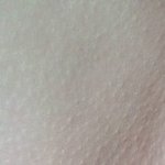 [청소년의성] 항상<b>닭살</b>이돋아잇는거