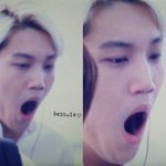 [EXO] <b>이런</b> <b>코</b>는 수술 어케해야댐