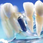 유디치과 손을 들어준 대법원 판결