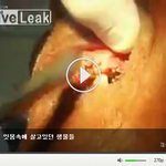 [공미니] 극혐] 이를 안 닦은 사람의 잇몸속에 살고있던 <b>생물</b>들