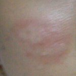 [조언부탁] 얼굴 <b>피지</b>같은거짜면