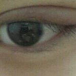 [EXO] <b>다래끼</b>나본사람 드루와