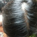 이 정도면 <b>탈모</b>인가요.. .? 사진 유