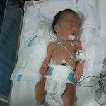 미숙아로 태어난 둘째 출산 후기.