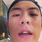 [공포베스트] 빈지노 엽기 <b>앞니</b>