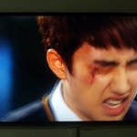 [EXO] 경수아파여..빠르게게또