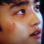 [EXO] 강우야 약국사줄게 <b>후시</b><b>딘</b>니가다발라..