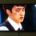 [EXO] 경수얼굴상처<b>아쥬</b>조금고퀄