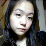 [EXO] 이마 <b>모발</b>이식 하기전의 민아