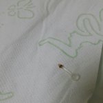 [EXO] 혐주의)피어싱 뺐는데 이거 <b>염증</b>난거야?
