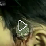 [공미니] 극혐] 구더기가 <b>대량</b>으로 솟은 소년