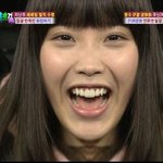 [EXO] 아이유 <b>vs</b> 나나 성형 전