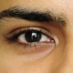 [추억파리여] 성형수술의 끝판왕