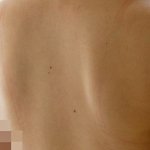 [19] (사진有)비키니입을건데 등평가좀..!