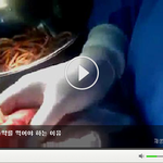 [공미니] 약혐] 구충제를 꼭 먹어야하는 이유