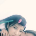 [에이핑크] <b>보미</b>기습 볼 뽀뽀에 일그러진 얼굴표정 초롱