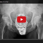 [헐ㅡㅡ] 고객의 롤렉스를 xx에 숨긴 안마걸