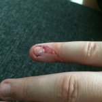[<b>공포</b>베스트] 보기만해도 고통이 느껴지는 사진