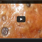 [<b>도도</b>] (충격) 속이 시원한 블랙헤드 제거