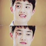 [EXO] <b>가슴성형</b> 많이 아픔?