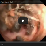 [공토다] 충격) <b>귀지</b> 파기