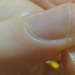 [EXO] <b>손톱</b> 가장자리가 갈라졌는데