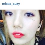 [수지숮이] 수지 쌍수했어요??