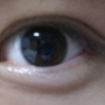 눈 <b>쌍수</b>한거같나요??
