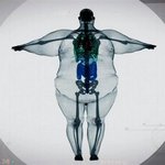 [EXO] 400kg 남자의 <b>엑스레이</b>