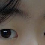 [댓글부탁] 쌍수해야될까요