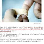 [추억파리여] 이건 공포!손가락에 <b>붕대</b> <b>감고</b> 916만원