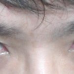 오빠 <b>눈</b>이 삼백안인데 교정<b>수술</b>이 필요할 정도인가요?
