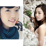 연예인 치아교정 <b>비포</b> 애프터