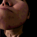 [<b>렛미인</b>4] <b>렛미인</b> 8년 교정 끝내고 양악수술 한 박상은