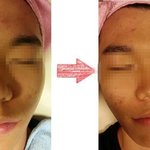 팜스스파 <b>외동</b> 트러블 후기