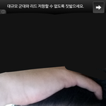 [도와주세요] 피부때문에 미치겠어요.