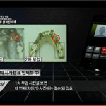 [추억파리여] 유병언 <b>사체</b> 치과의사의 소견