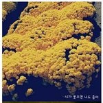 [펌질] 치킨 중독 말기 <b>증상</b>