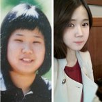 [EXO] 요즘 성형은 <b>본판</b>보다 의사기술임