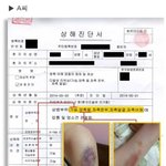[EXO] <b>에고</b> 멍든거봐